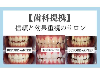 ホワイトニングサロン 宝塚の写真