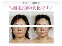 真美(Sinbi)の雰囲気(引き締めて上がる!若戻り小顔マジック♪)