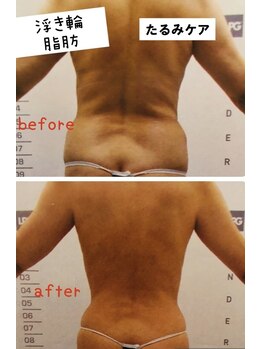 ビューティースパ/ブライダルに間に合う/背中映え!