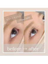 ダブリュー 草津店(W)/フラットラッシュ