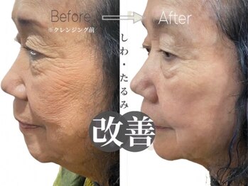 コーラルビューティー/大注目韓国コスメフェイシャル