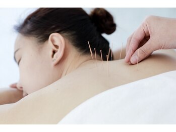 田中整骨鍼灸院 福岡白金院/鍼灸施術