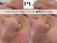 プルスキンサロン 大阪店(pull skin salon)/
