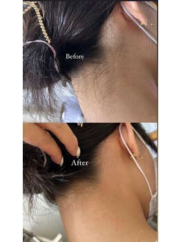 ルモア(Lumor)/レディース｜うなじWax