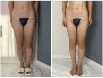 モア(moa)/茅ヶ崎/湘南/痩身