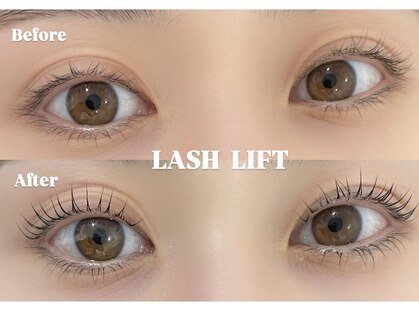 アテナ(ATENA)の写真