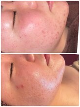 スペチアーレ 夙川/赤ちゃんの様な陶器肌に