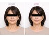 [エイジングケア]目元スッキリ小顔矯正◆75分