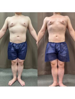 パラディ(PARADIS)/【40代男性】リバウンド後