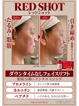 サロン ド フェイス モアナ(Salon de Faith Moana)/【フェイシャル】レッドショット