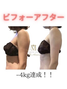 ミアモーレ(Mi Amore)/ブライダルの方にも◎二の腕集中