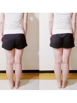 クーラクー(Coeur a Coeur)/初回　ビフォアフターモニター様