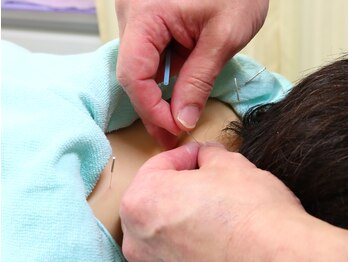 くどう鍼灸接骨院/鍼