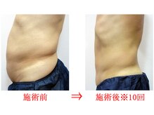 東京美容整体/ダイエット痩身 40代男性