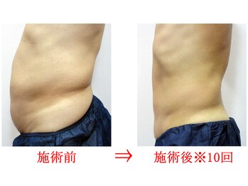 東京美容整体/ダイエット痩身 40代男性