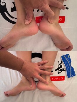 整体 王院長/『部位ごとに歪みをチェック』