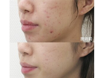 スリリアン 銀座/★お客さまビフォーアフター★