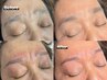 【一般様/眉毛】大革命! 30分クイック眉毛ワックス脱毛×白髪染め眉カラー