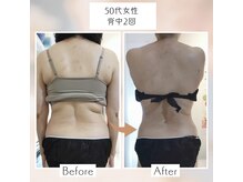 &Ｕ　Body Make Salon【痩身/小顔/姿勢ケア/リンパ】【3/5 NEW OPEN（予定）】 の雰囲気（宮城県初導入RFカッサプレート使用オーダーメイド痩身骨盤調整込）