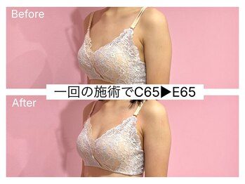 ククナ 新潟本店(KUKUNA)/*バストアップケア*