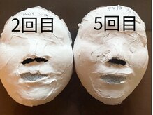 パール/石膏パックのビフォーアフター