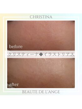 ボーテ ドゥ ランジュ(BEAUTE DE L’ANGE.)/◆イラストリアス◆