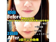 コルギサロン ベルエット(bell'et)の雰囲気（施術する度にお顔が引き締まっていく感動をご体感くださいませ☆）