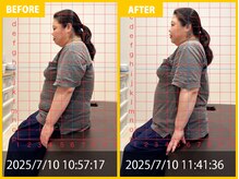 整体院 元 光の森店/姿勢の悪さ・巻き肩の悩み