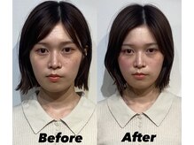 コルミチョン サロン(骨美整 salon)/Before・After