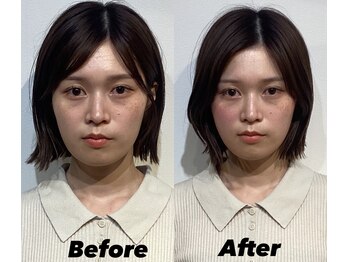 コルミチョン サロン(骨美整 salon)/Before・After
