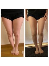 ヨサパーク クローバー 聖蹟桜ヶ丘店(YOSA PARK CLOVER)/Before/After