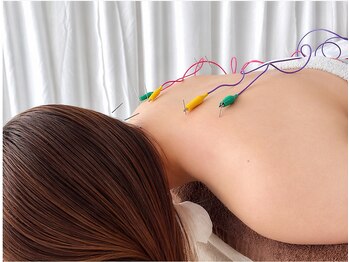 リリアン(Riliane)の写真/鍼灸でリラックス!コリや痛みに特化、初めてでもおすすめの穏やかな時間♪