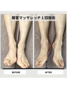 ル ボヌール/腸管マッサレッチでバランス調整