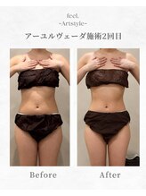 アートスタイルフィール(Art Style feel.)/アーユルヴェーダ2回目の効果