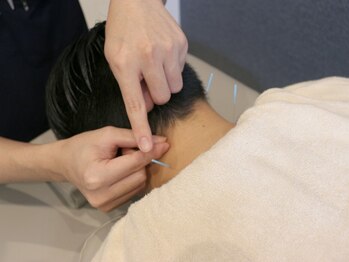 むげん整骨院鍼灸院 大津膳所/ 頑固なコリには鍼灸施術◎