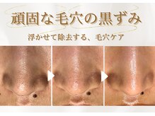 アイスリー(i III)