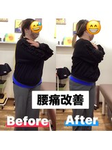 ヒデ整体院(Hide整体院)/猫背矯正骨盤矯正B/A肩こり腰痛