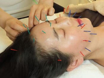 ジョンファ目黒鍼灸院の写真/【美容も不調ケアも叶えたい方へ】たるみ・シワ・くすみなどの肌悩みに,美容鍼で深層筋へアプローチ。