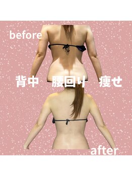 エアージーモ(Air Gmo)/背中　腰　二の腕before→after