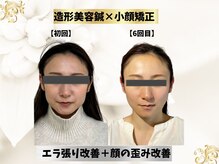 エモシオン トウキョウ(EMOTION TOKYO)/造形フェイス