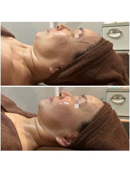 サリーエミリー 船橋店(SallyEmiry)/ハーブ×コルギは相性抜群☆