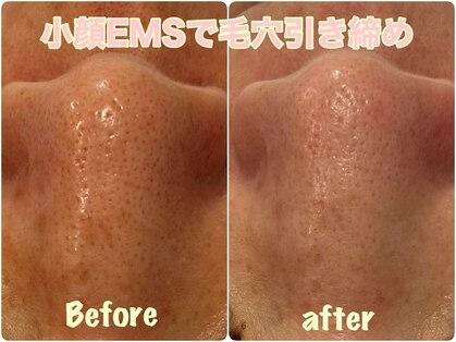 エルブラン(Aile-blanc)の写真