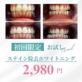 シンデレラ(Cinderella)