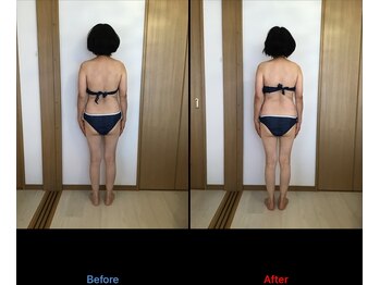 サロン シエラ/施術1回 &nbsp;60代 