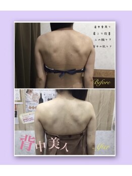 プリマプリート 岐阜店/ブライダルエステ　二の腕背中