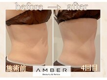 アンバー 恵比寿(AMBER)/ぽっこりお腹を改善したい