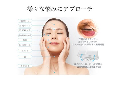 アルセの写真