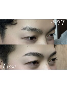 メンズフェイシャル