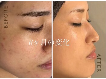 オーシャンブルーム 目黒(OceanBloom)/【スタッフ変化】アンストレス