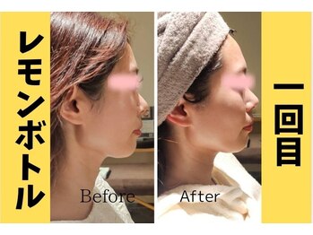 アン 銀座(ann)/頬のお肉小さくなあれ